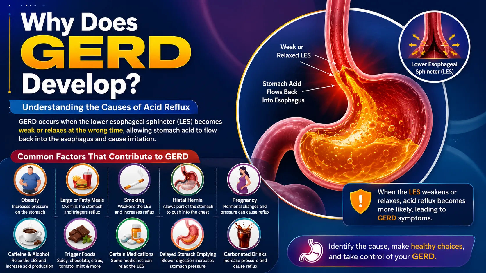 Why Does GERD Develop